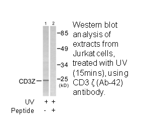 Product image for CD3 &zeta;  (Ab-42) Antibody