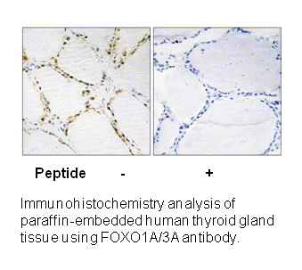Product image for FOXO1A/3A (Ab-322/325) Antibody