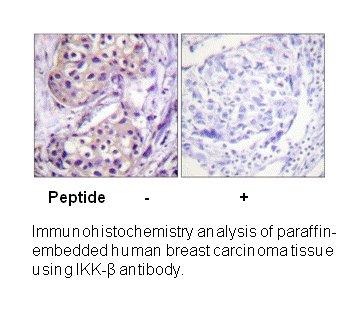 Product image for IKK-&beta; (Ab-199) Antibody