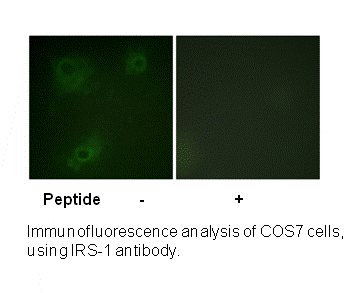 Product image for IRS-1 (Ab-323) Antibody