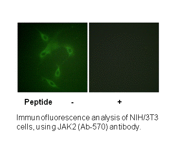 Product image for JAK2 (Ab-570) Antibody