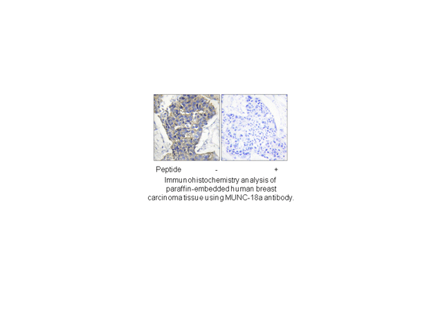 Product image for LAT (Ab-191) Antibody