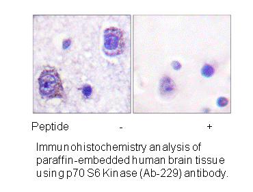 Product image for p70 S6 Kinase (Ab-229) Antibody