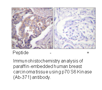 Product image for p70 S6 Kinase (Ab-371) Antibody
