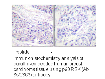 Product image for p90 RSK (Ab-359/363) Antibody