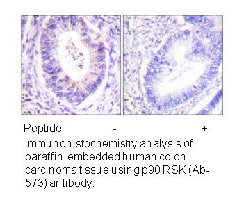 Product image for p90 RSK (Ab-573) Antibody
