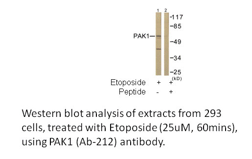 Product image for PAK1 (Ab-212) Antibody