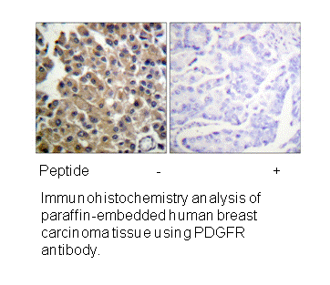 Product image for PDGFRB (Ab-1009) Antibody