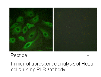 Product image for PLB (Ab-16/17) Antibody