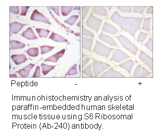 Product image for S6 Ribosomal Protein (Ab-240) Antibody