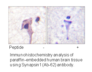 Product image for Synapsin1 (Ab-62) Antibody