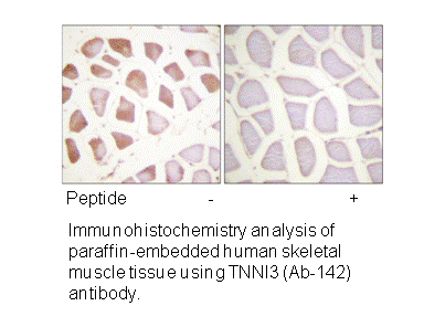 Product image for TNNI3 (Ab-142) Antibody