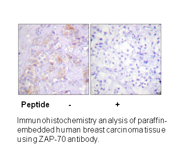 Product image for ZAP-70 (Ab-315) Antibody