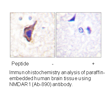 Product image for NMDAR1 (Ab-890) Antibody