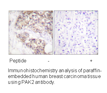 Product image for PAK2 (Ab-20) Antibody