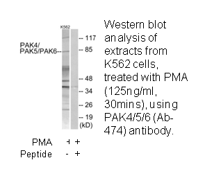 Product image for PAK4/5/6 (Ab-474) Antibody