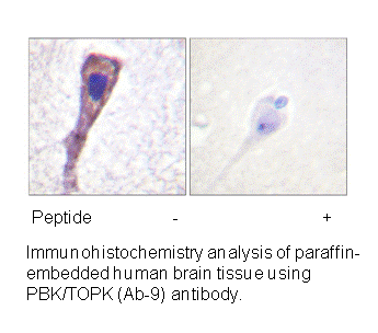Product image for PBK/TOPK (Ab-9) Antibody