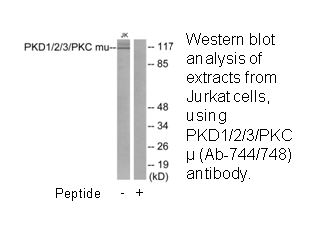 Product image for PKD1/2/3/PKC &mu; (Ab-744/748) Antibody