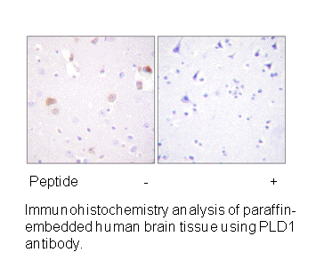 Product image for PLD1 (Ab-561) Antibody