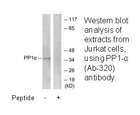 Product image for PP1-&alpha; (Ab-320) Antibody