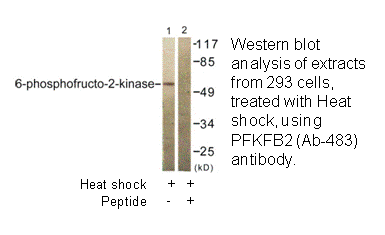 Product image for Fructose 6 Phosphate Kinase (Ab-483) Antibody