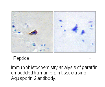 Product image for Aquaporin 2 (Ab-256) Antibody