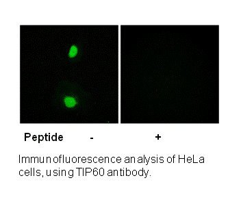 Product image for TIP60 (Ab-86) Antibody