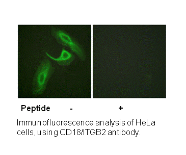 Product image for CD18/ITGB2 (Ab-758) Antibody