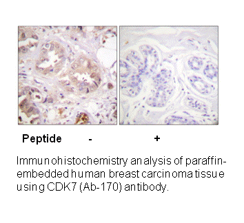 Product image for CDK7 (Ab-170) Antibody