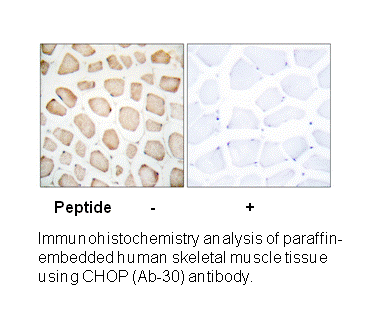 Product image for CHOP (Ab-30) Antibody