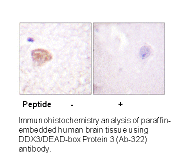Product image for DDX3/DEAD-box Protein 3 (Ab-322) Antibody