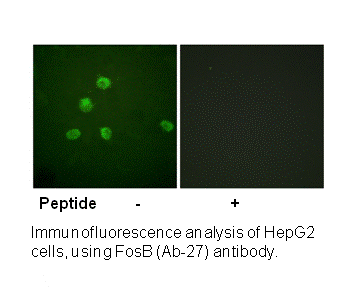 Product image for FosB (Ab-27) Antibody