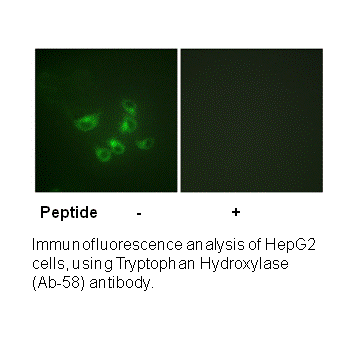 Product image for Tryptophan Hydroxylase (Ab-58) Antibody