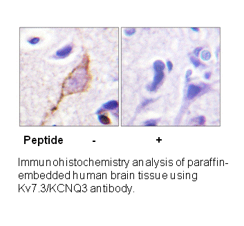 Product image for Kv7.3/KCNQ3 (Ab-246) Antibody