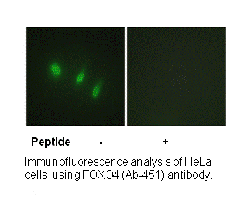Product image for FOXO4 (Ab-451) Antibody