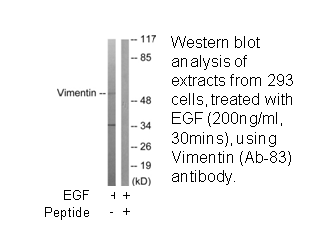 Product image for Vimentin (Ab-83) Antibody