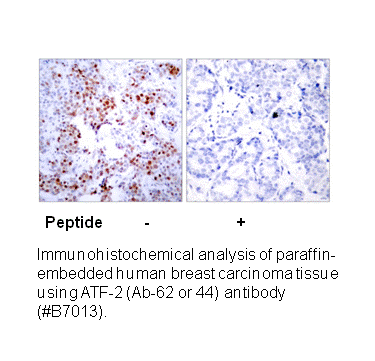 Product image for ATF2 (Ab-62 or 44) Antibody