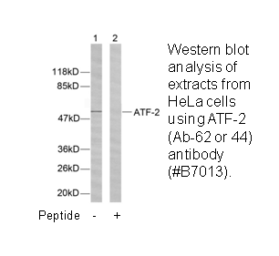 Product image for ATF2 (Ab-62 or 44) Antibody
