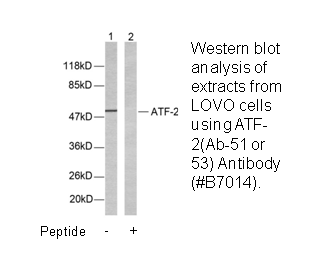 Product image for ATF2 (Ab-69 or 51) Antibody