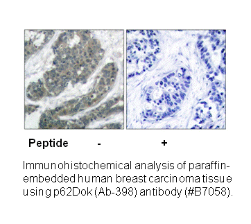 Product image for p62 Dok (Ab-398) Antibody