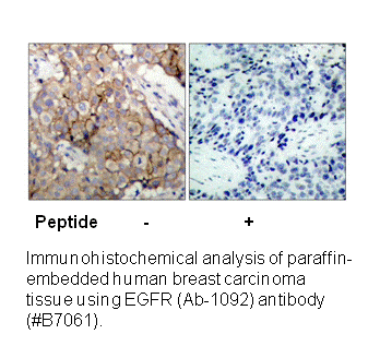 Product image for EGFR (Ab-1092) Antibody