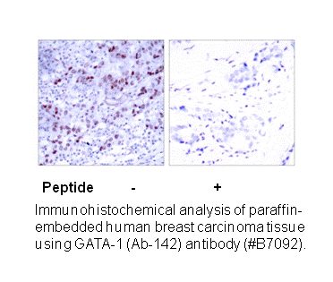 Product image for GATA1 (Ab-142) Antibody