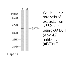 Product image for GATA1 (Ab-142) Antibody