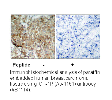 Product image for IGF1R (Ab-1161) Antibody