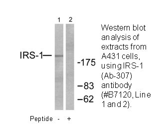Product image for IRS-1 (Ab-307) Antibody
