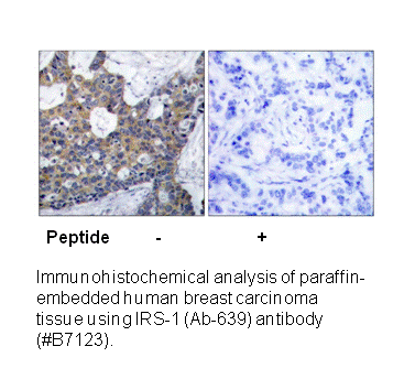 Product image for IRS-1 (Ab-639) Antibody