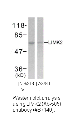 Product image for LIMK1 (Ab-508) Antibody