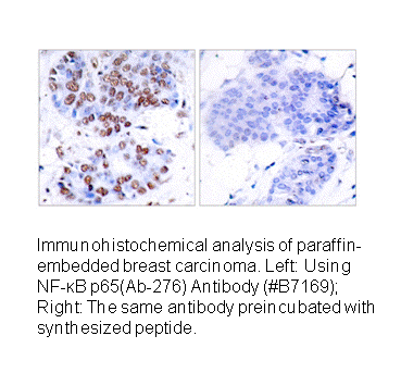 Product image for NF-&kappa;B p65 (Ab-276) Antibody