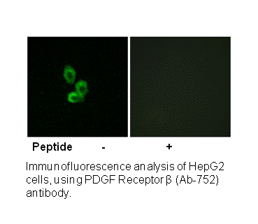Product image for PDGF Receptor &beta; (Ab-752) Antibody