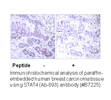 Product image for STAT4 (Ab-693) Antibody